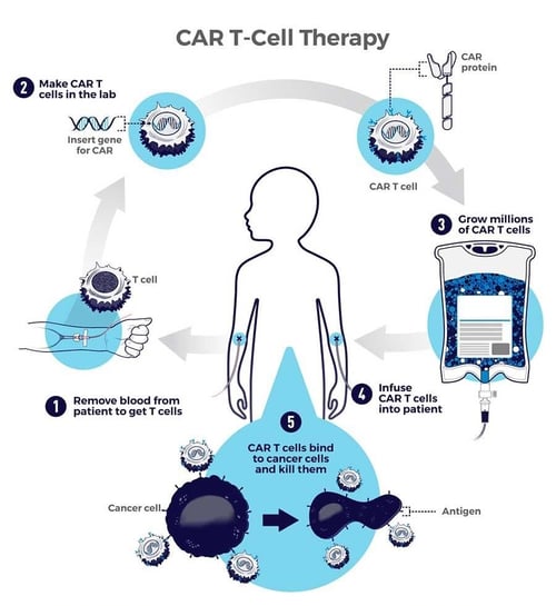 CAR-T-Cell-therapy-1